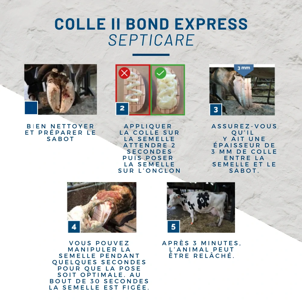 Lepidlo na paznehty Septicare II Bond Express XL, 250 ml